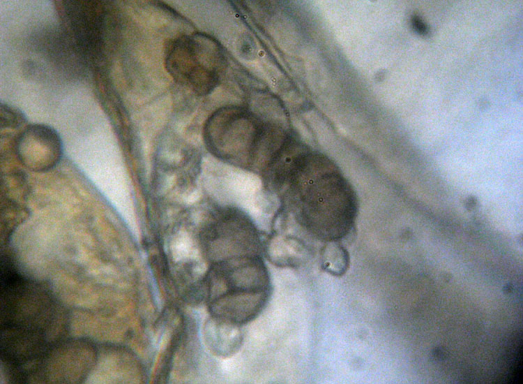 Patologia vegetale, fungo, myxo...?